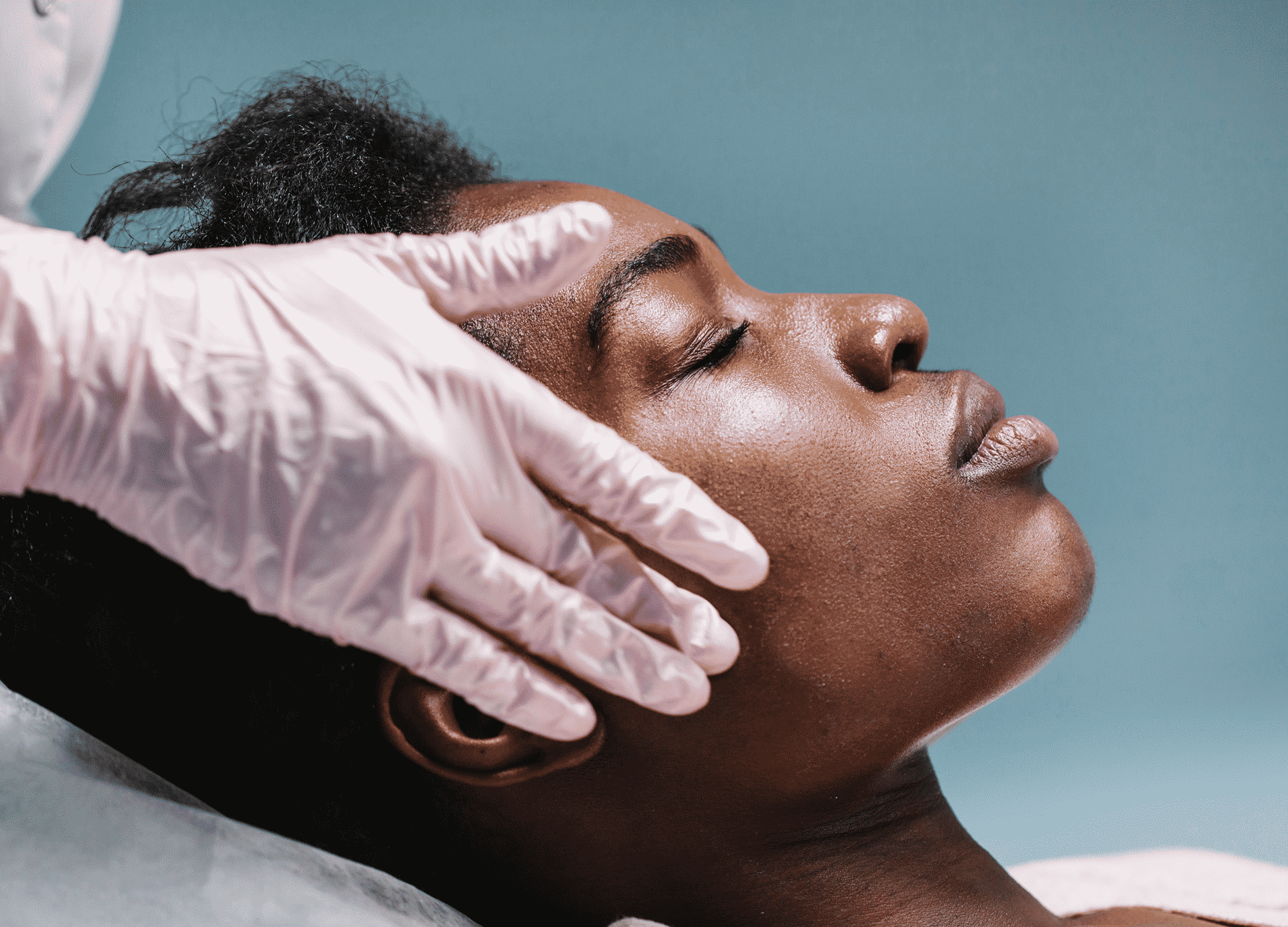 rs_chemical-peel-or-laser